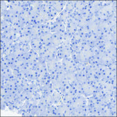 Anti-AGTR1 antibody produced in rabbit Prestige Antibodies® Powered by Atlas Antibodies, affinity isolated antibody, buffered aqueous glycerol solution