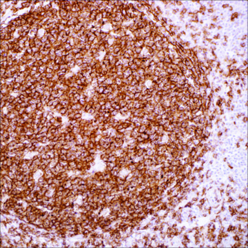 CD19 (EP169) Rabbit Monoclonal Primary Antibody