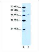 Anti-FECH (AB1) antibody produced in rabbit affinity isolated antibody