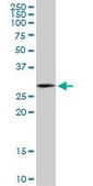Monoclonal Anti-HSD17B12 antibody produced in mouse clone 4G11, purified immunoglobulin, buffered aqueous solution