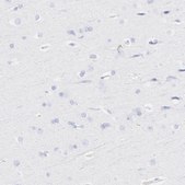 Anti-S100A12 antibody produced in rabbit Prestige Antibodies® Powered by Atlas Antibodies, affinity isolated antibody, buffered aqueous glycerol solution