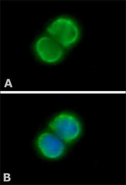 Anti-PARP antibody produced in rabbit affinity isolated antibody, buffered aqueous solution