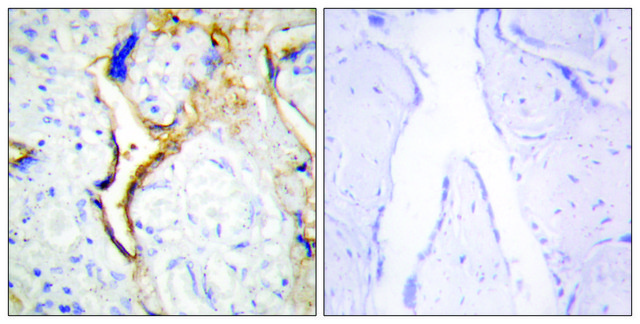 Anti-CKI-&#949; antibody produced in rabbit affinity isolated antibody