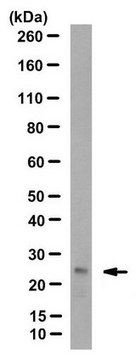 Anti-Ubiquitinated Histone H2B (Lys123) Antibody, clone 1B3F12/A9 clone 1B3F12/A9, from mouse