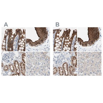 Anti-VIL1 antibody produced in rabbit Ab1, Prestige Antibodies&#174; Powered by Atlas Antibodies, affinity isolated antibody, buffered aqueous glycerol solution