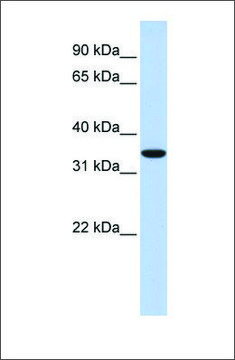 Anti-MARCH1 antibody produced in rabbit affinity isolated antibody