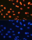 Anti-Ku80 antibody produced in rabbit