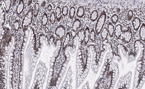 Anti-SNRNP40 Antibody, clone 1E15 ZooMAb&#174; Rabbit Monoclonal recombinant, expressed in HEK 293 cells