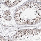 Anti-PRDM10 antibody produced in rabbit Prestige Antibodies® Powered by Atlas Antibodies, affinity isolated antibody, buffered aqueous glycerol solution
