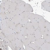 Anti-PSMB10 antibody produced in rabbit Prestige Antibodies® Powered by Atlas Antibodies, affinity isolated antibody, buffered aqueous glycerol solution