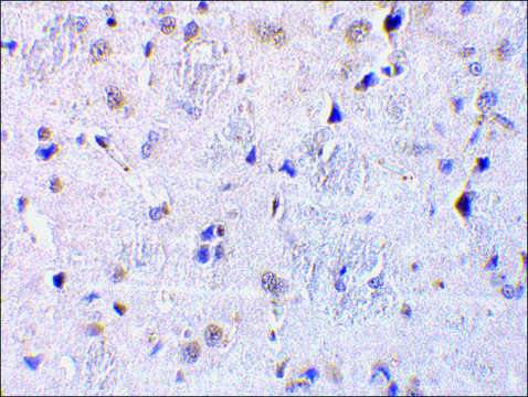 Anti-CTRP7 (ab2) antibody produced in rabbit affinity isolated antibody, buffered aqueous solution