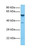 Anti-GLIS2 antibody produced in rabbit affinity isolated antibody