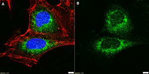 Anti-PAI-1 Antibody, clone 1C11 ZooMAb® Rabbit Monoclonal recombinant, expressed in HEK 293 cells