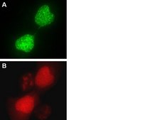 LentiBrite GFP-Rad51 Lentiviral Biosensor