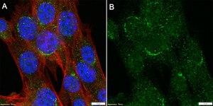 Anti-LRBA Antibody, clone 3H22 ZooMAb® Rabbit Monoclonal recombinant, expressed in HEK 293 cells
