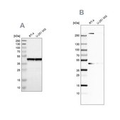 Anti-SMARCB1 antibody produced in rabbit Prestige Antibodies&#174; Powered by Atlas Antibodies, affinity isolated antibody, buffered aqueous glycerol solution