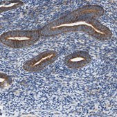 Anti-STOM antibody produced in rabbit Ab2, Prestige Antibodies® Powered by Atlas Antibodies, affinity isolated antibody, buffered aqueous glycerol solution