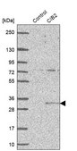 Anti-CIB2 antibody produced in rabbit Prestige Antibodies® Powered by Atlas Antibodies, affinity isolated antibody, buffered aqueous glycerol solution