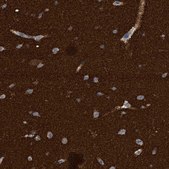Anti-AMPH antibody produced in rabbit Prestige Antibodies® Powered by Atlas Antibodies, affinity isolated antibody, buffered aqueous glycerol solution, Ab2