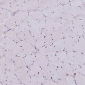 Anti-ATG3 antibody produced in rabbit Prestige Antibodies® Powered by Atlas Antibodies, affinity isolated antibody, buffered aqueous glycerol solution