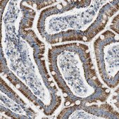 Anti-GSTK1 antibody produced in rabbit Prestige Antibodies® Powered by Atlas Antibodies, affinity isolated antibody, buffered aqueous glycerol solution