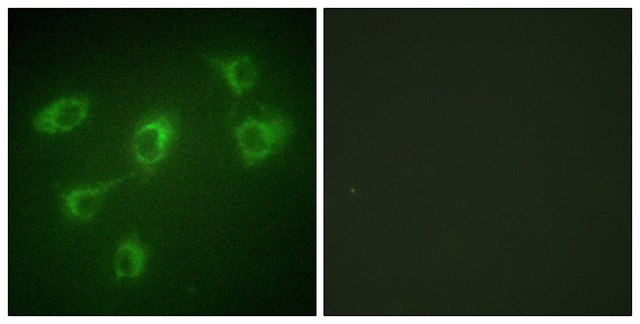 Anti-TGF &#946; Receptor III antibody produced in rabbit affinity isolated antibody