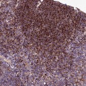 Anti-HLA-DOA antibody produced in rabbit Prestige Antibodies® Powered by Atlas Antibodies, affinity isolated antibody, buffered aqueous glycerol solution