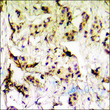 抗 磷酸化 hnRNP K (pSer 284 ) 兔抗 affinity isolated antibody