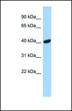 Anti-SIAH2 antibody produced in rabbit affinity isolated antibody