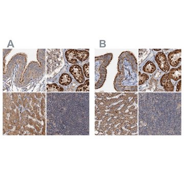 Anti-CEP68 antibody produced in rabbit Prestige Antibodies&#174; Powered by Atlas Antibodies, affinity isolated antibody, buffered aqueous glycerol solution