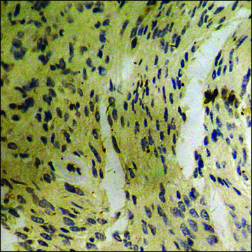 Anti-phospho-EGFR (pSer1070) antibody produced in rabbit affinity isolated antibody