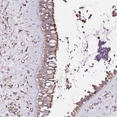 Anti-KLHL11 antibody produced in rabbit Prestige Antibodies® Powered by Atlas Antibodies, affinity isolated antibody, buffered aqueous glycerol solution