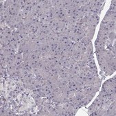 Anti-ENTPD8 antibody produced in rabbit Prestige Antibodies® Powered by Atlas Antibodies, affinity isolated antibody, buffered aqueous glycerol solution