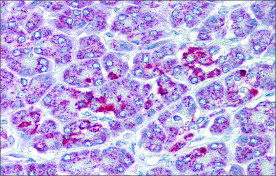 Anti-SLC39A5 (AB2) antibody produced in rabbit affinity isolated antibody