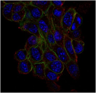 Anti-Trpv4 Antibody, clone 1B2.6 clone 1B2.6, from mouse