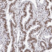 抗-IRF2BP2 兔抗 Prestige Antibodies® Powered by Atlas Antibodies, affinity isolated antibody, buffered aqueous glycerol solution
