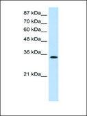 Anti-MBNL1 (AB1) antibody produced in rabbit affinity isolated antibody