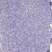 Anti-XCL1 antibody produced in rabbit Prestige Antibodies® Powered by Atlas Antibodies, affinity isolated antibody, buffered aqueous glycerol solution