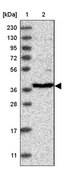 Anti-RFC3 antibody produced in rabbit Prestige Antibodies® Powered by Atlas Antibodies, affinity isolated antibody, buffered aqueous glycerol solution