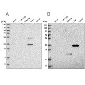 Anti-RGN antibody produced in rabbit Prestige Antibodies® Powered by Atlas Antibodies, affinity isolated antibody, buffered aqueous glycerol solution, ab1