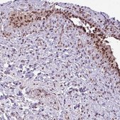 Anti-ZNF217 antibody produced in rabbit Prestige Antibodies® Powered by Atlas Antibodies, affinity isolated antibody, buffered aqueous glycerol solution