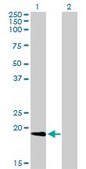 Monoclonal Anti-NME1 antibody produced in mouse clone 2H1, purified immunoglobulin, buffered aqueous solution