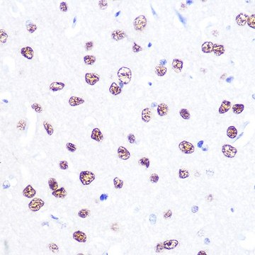 Anti- ATF2 antibody produced in rabbit