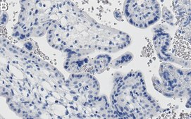 Anti-ACSL3 Antibody, clone 1I18 ZooMAb® Rabbit Monoclonal recombinant, expressed in HEK 293 cells