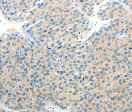 Anti-SCN10A antibody produced in rabbit affinity isolated antibody