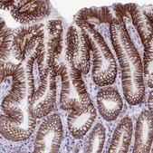 Anti-CDC42EP5 antibody produced in rabbit Prestige Antibodies® Powered by Atlas Antibodies, affinity isolated antibody, buffered aqueous glycerol solution