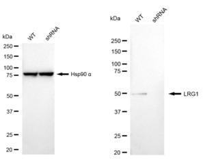 KD-Validated Anti Leucine Rich Alpha-2-Glycoprotein 1 Antibody, clone 24GB545, Rabbit Monoclonal clone 24GB545, recombinant rabbit monoclonal, expressed in HEK293 cells