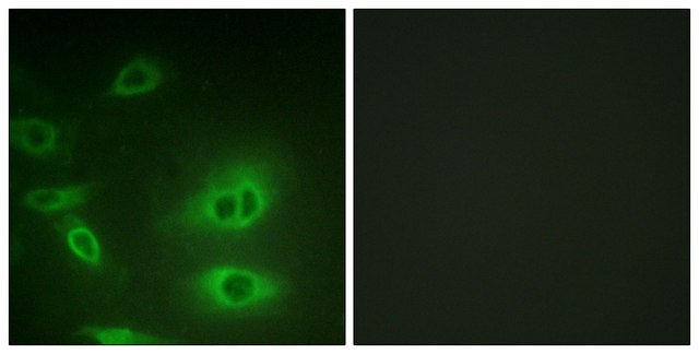 Anti-ATP1 &#945; antibody produced in rabbit affinity isolated antibody