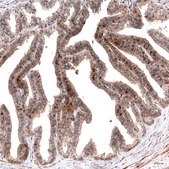 Monoclonal Anti-ID1 antibody produced in mouse Prestige Antibodies® Powered by Atlas Antibodies, clone CL11995, purified immunoglobulin, buffered aqueous glycerol solution