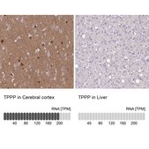 Anti-TPPP antibody produced in rabbit Prestige Antibodies® Powered by Atlas Antibodies, affinity isolated antibody, buffered aqueous glycerol solution